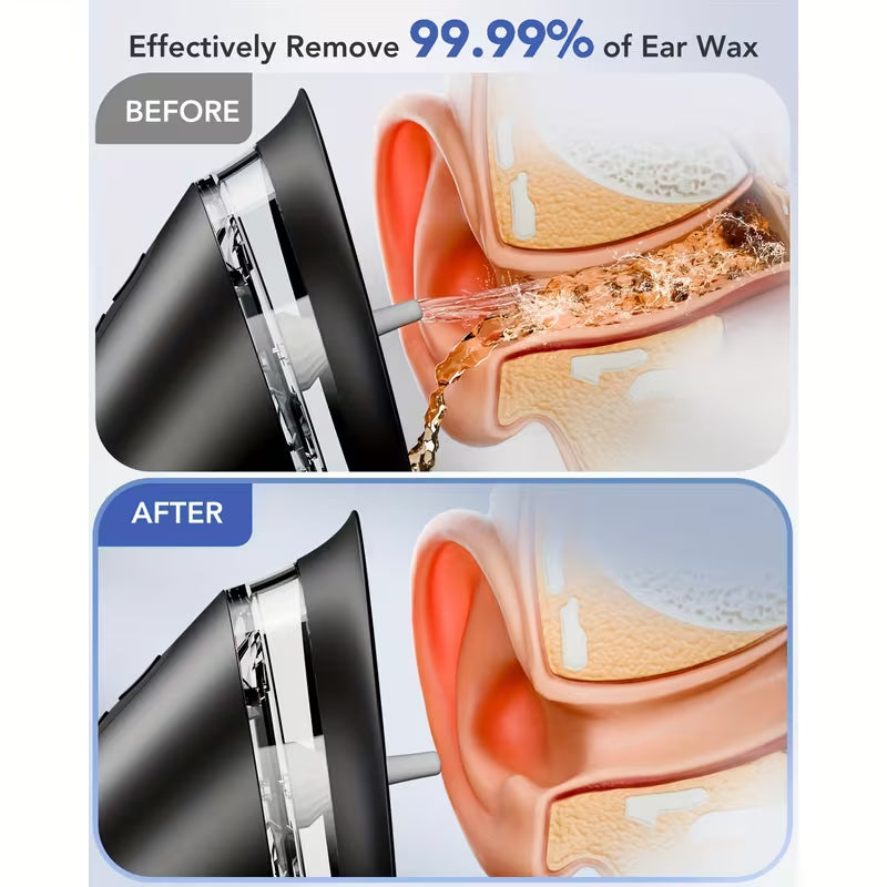 QuickClear Ear Care Kit